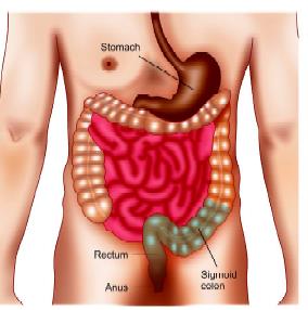 Abdominoperineal Resection (APR) Surgery_Ath_Ayush