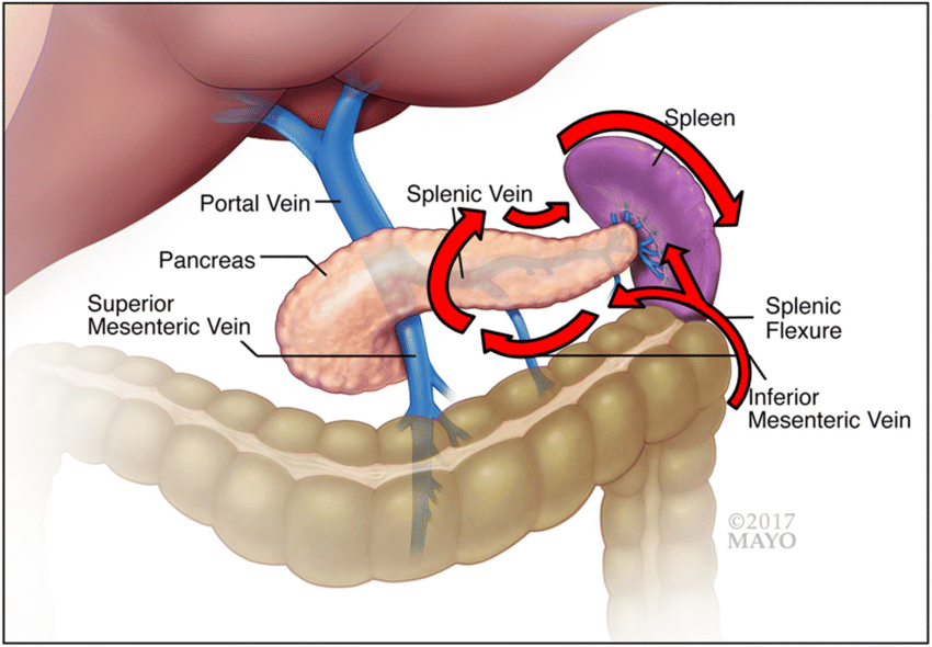 Spleen-Preserving Laparoscopic Distal Pancreatectomy_AthAyush
